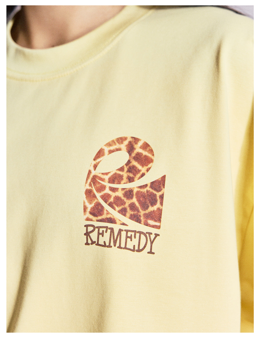 Remedy Animal Logo Print Tee | Face 3 Face